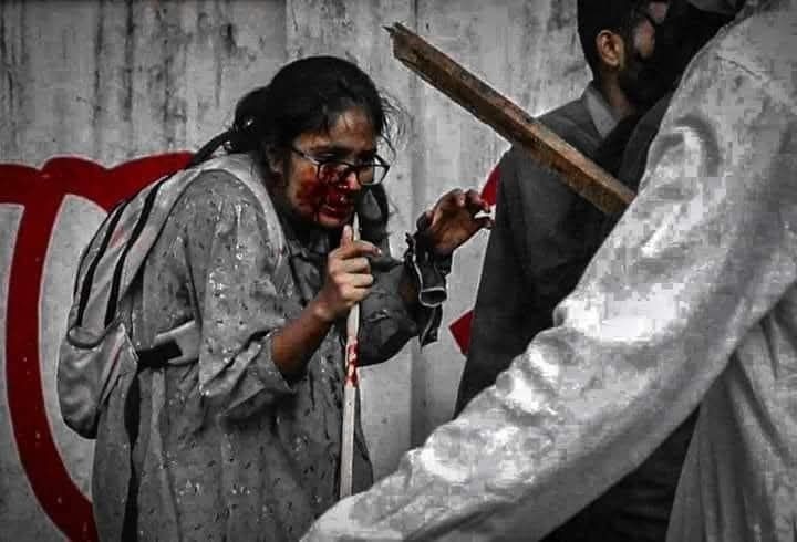 রক্তমাখা মুখ নিয়ে এগিয়ে যাওয়া তন্বীর ছবি থেকে জ্বলল বিক্ষোভের স্ফুলিঙ্গ